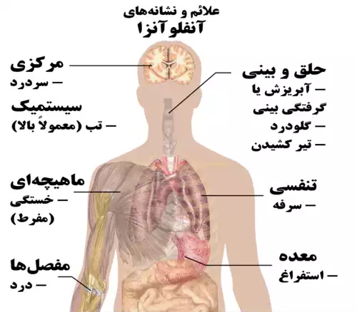 معنی کلمه آنفلوانزا در فرهنگ معین