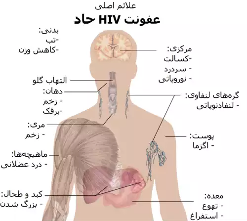 معنی کلمه ایدز در فرهنگ معین