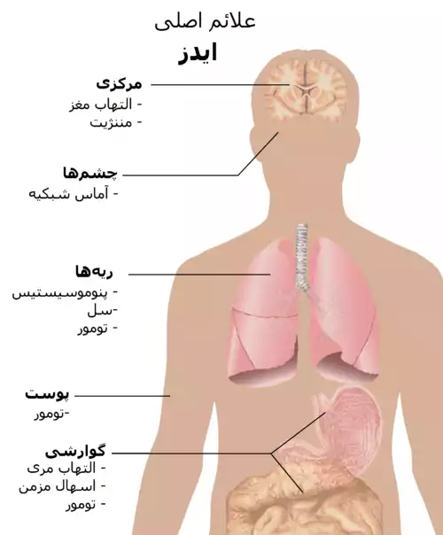 معنی کلمه ایدز در فرهنگستان زبان و ادب