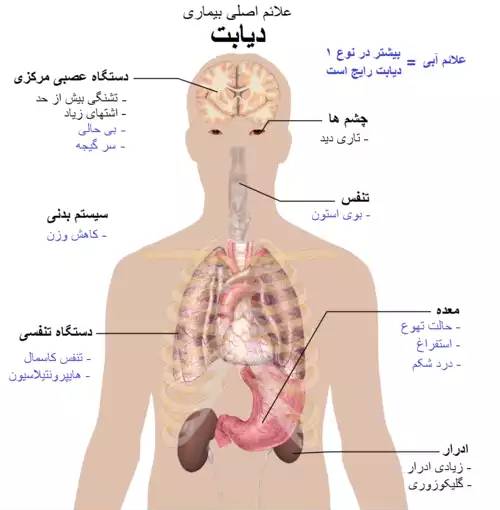 معنی کلمه دیابت در فرهنگ عمید