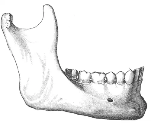 جملاتی از کاربرد کلمه فک پایین