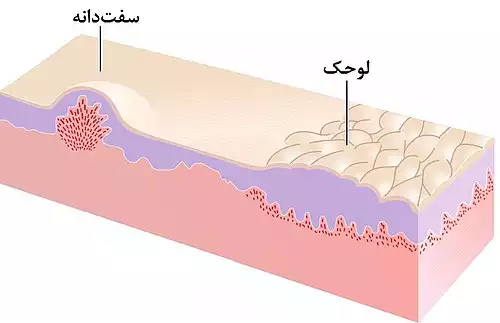 سفت دانه